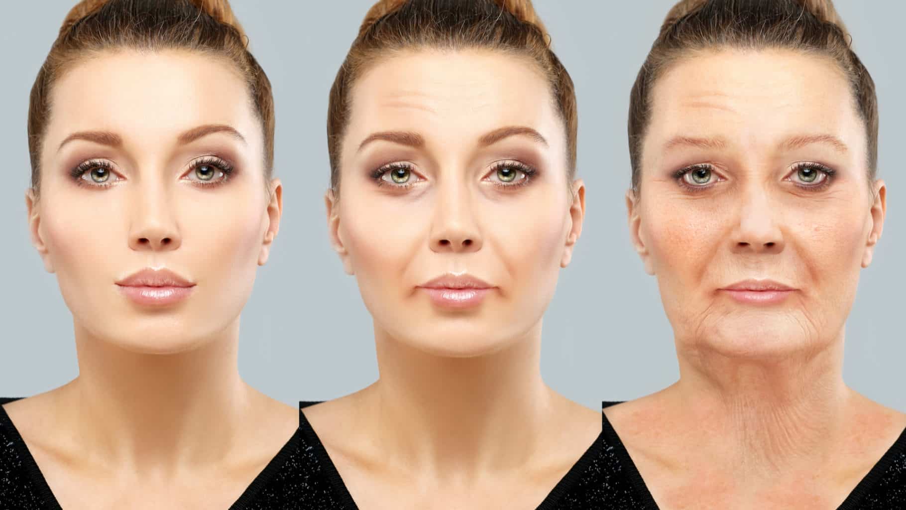 https://florida.passportmedical.com/wp-content/uploads/sites/21/2022/12/Facelift-Procedure-1820x1024-min.jpg